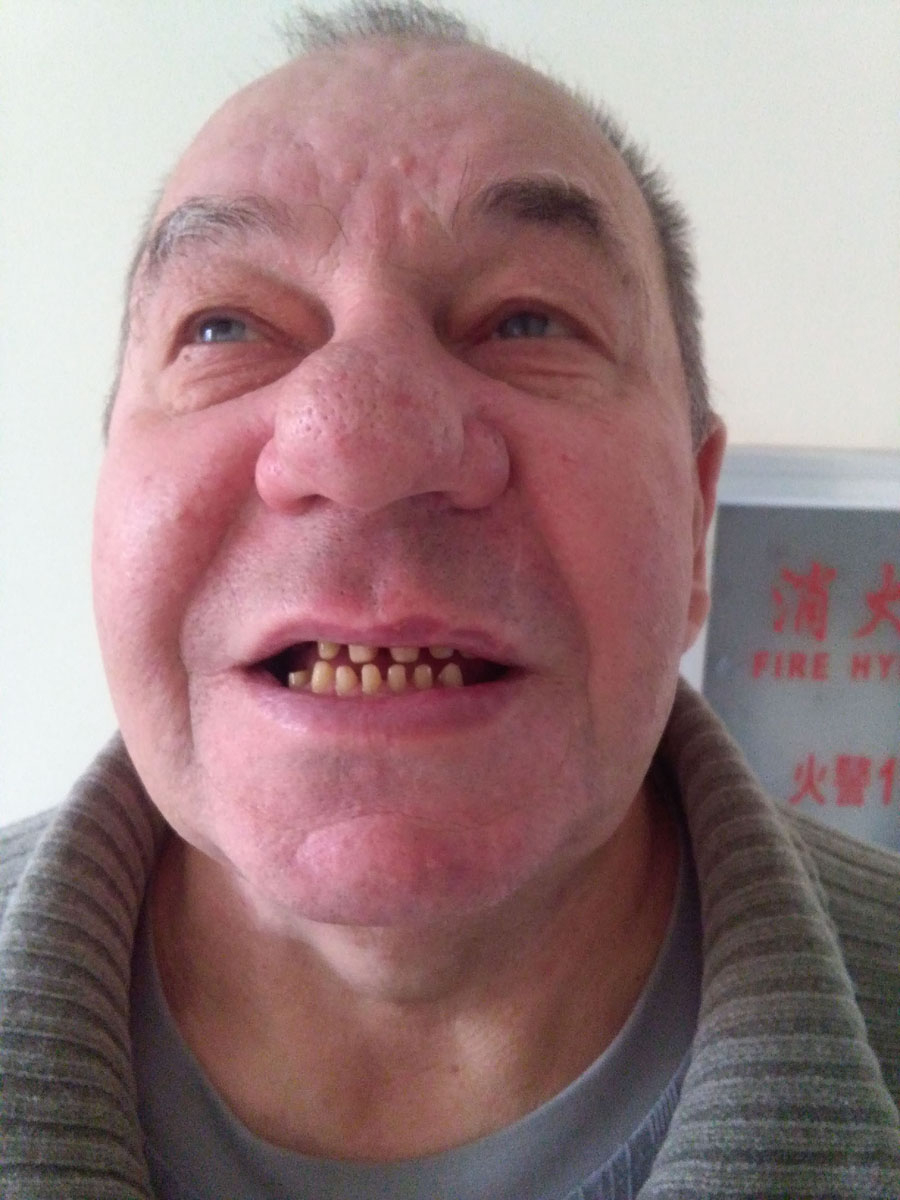 Отзыв о протезировании зубов в Китае